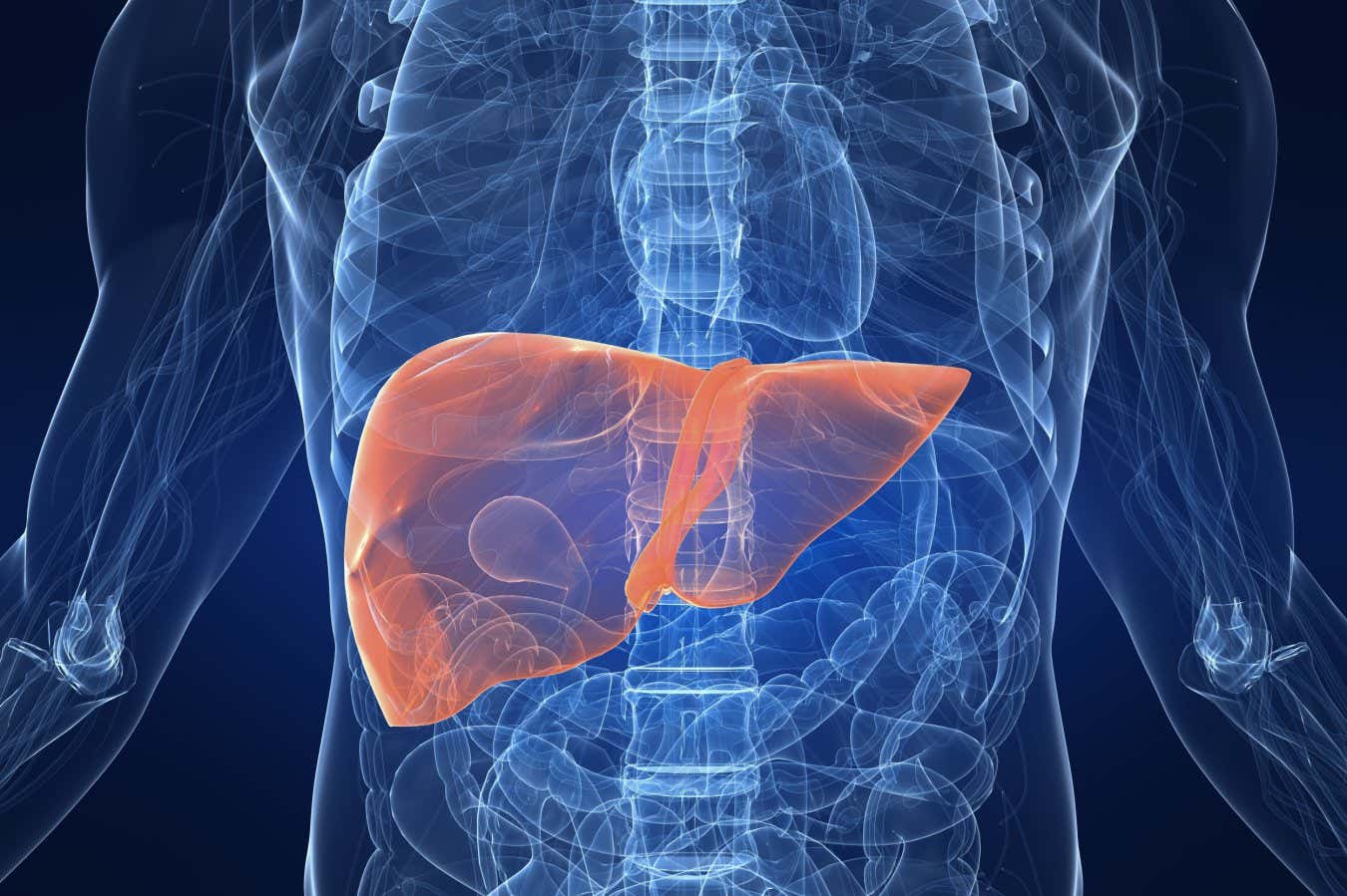 Drogas como Wegovy podem ser eficazes no tratamento da doença hepática gordurosa